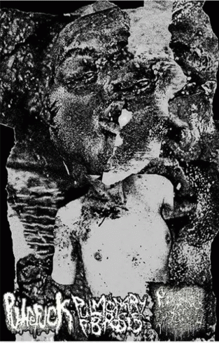 Putrefuck : Putrefuck - Pulmonary Fibrosis - Purulent Cystocentesis